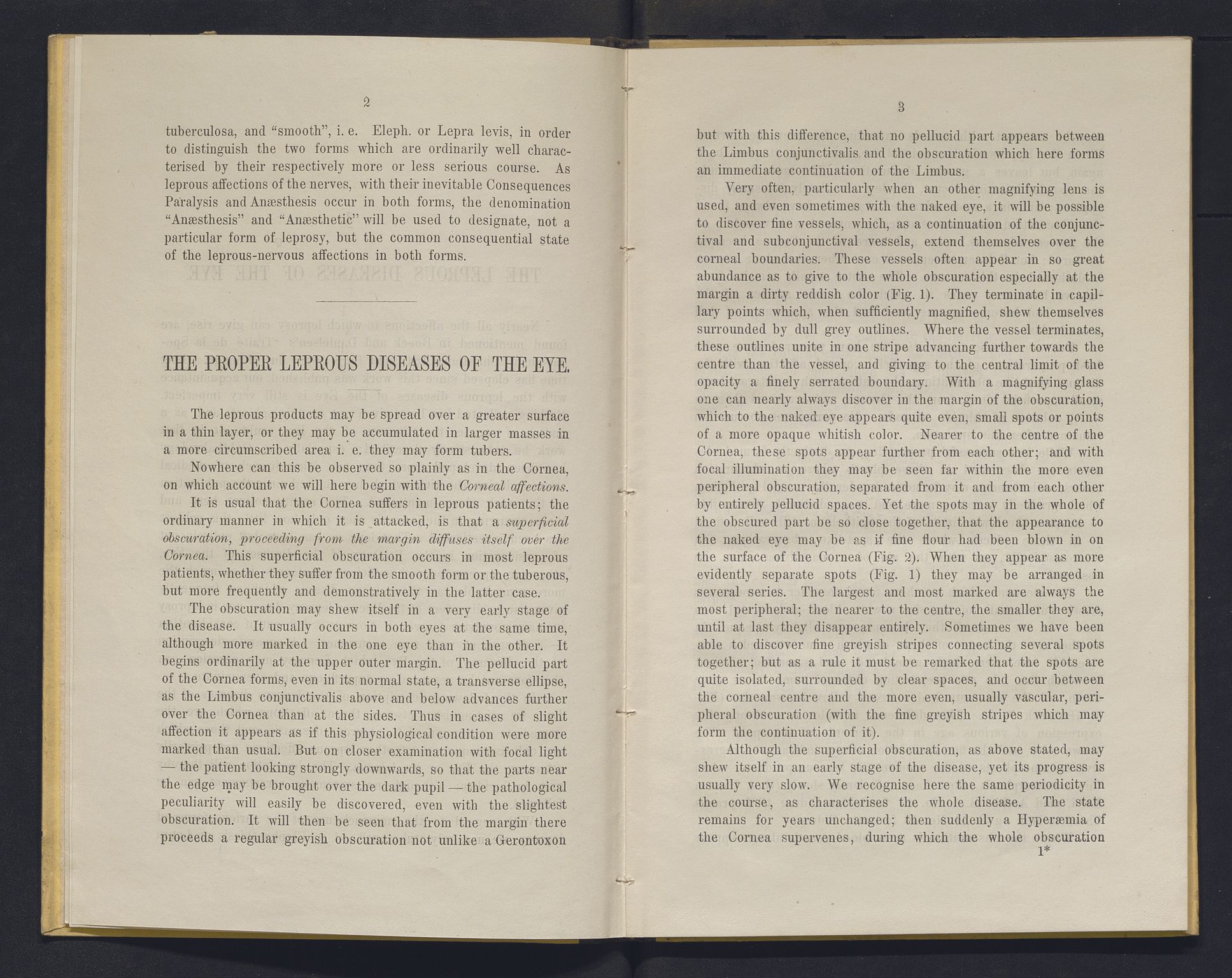 Lepraarkiver - Overlegen for den spedalske sykdom, AV/SAB-A-61001/E/L0001: The Leprous Diseases of the Eye with 6 colored plates by Dr. O.B. Bull and Dr. G.A. Hansen, 1873, p. 2-3