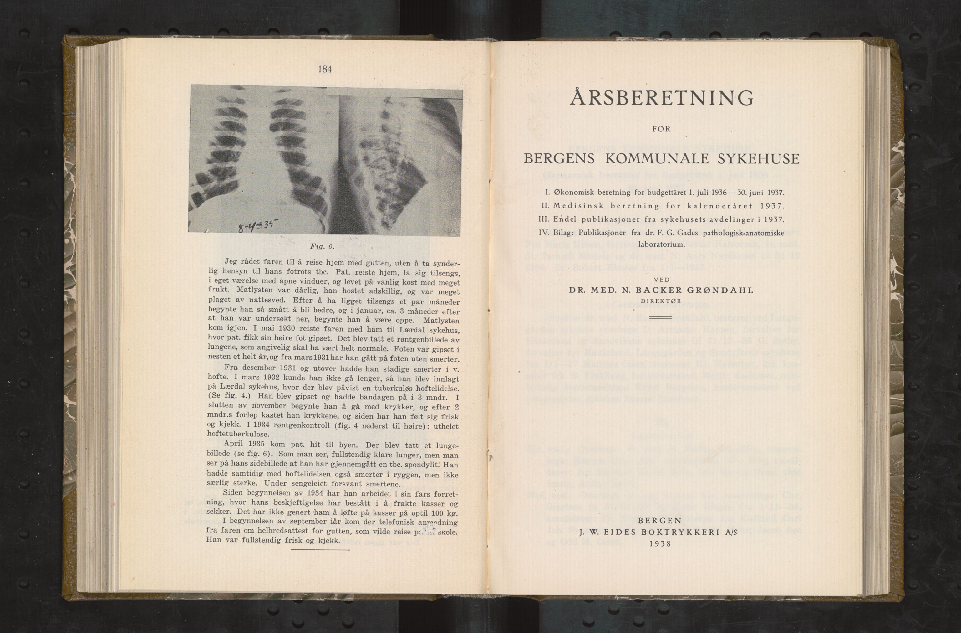 Haukeland Sykehus, Direktøren, BBA/A-2050.04/Æa/L0005: Årsberetninger 1933-1937, 1933-1937, p. 298