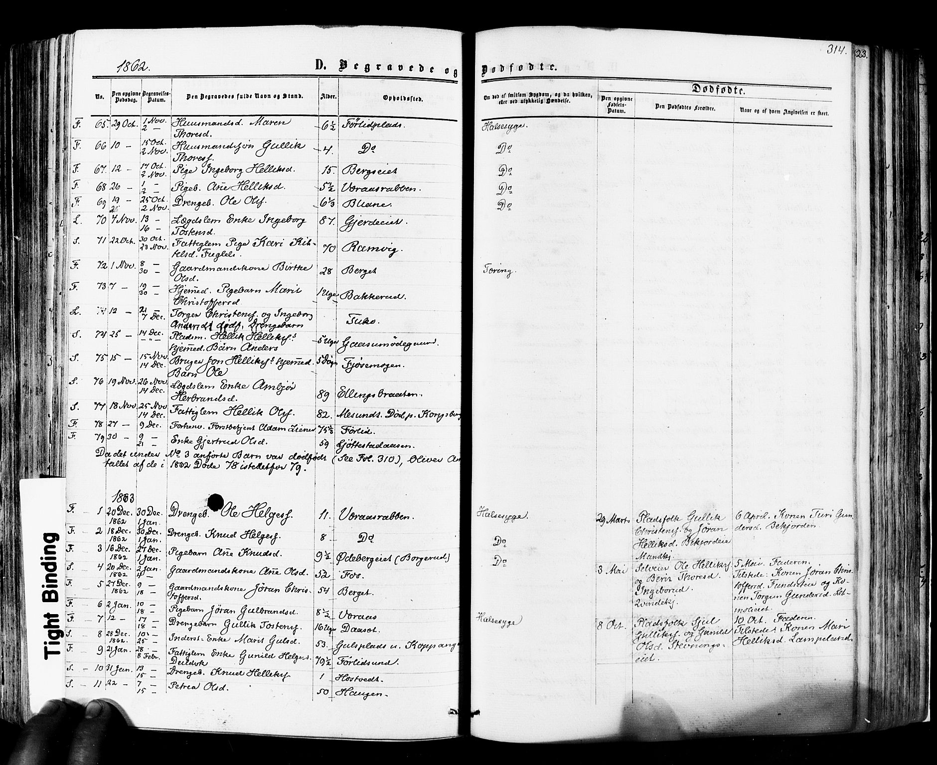 Flesberg kirkebøker, SAKO/A-18/F/Fa/L0007: Parish register (official) no. I 7, 1861-1878, p. 314