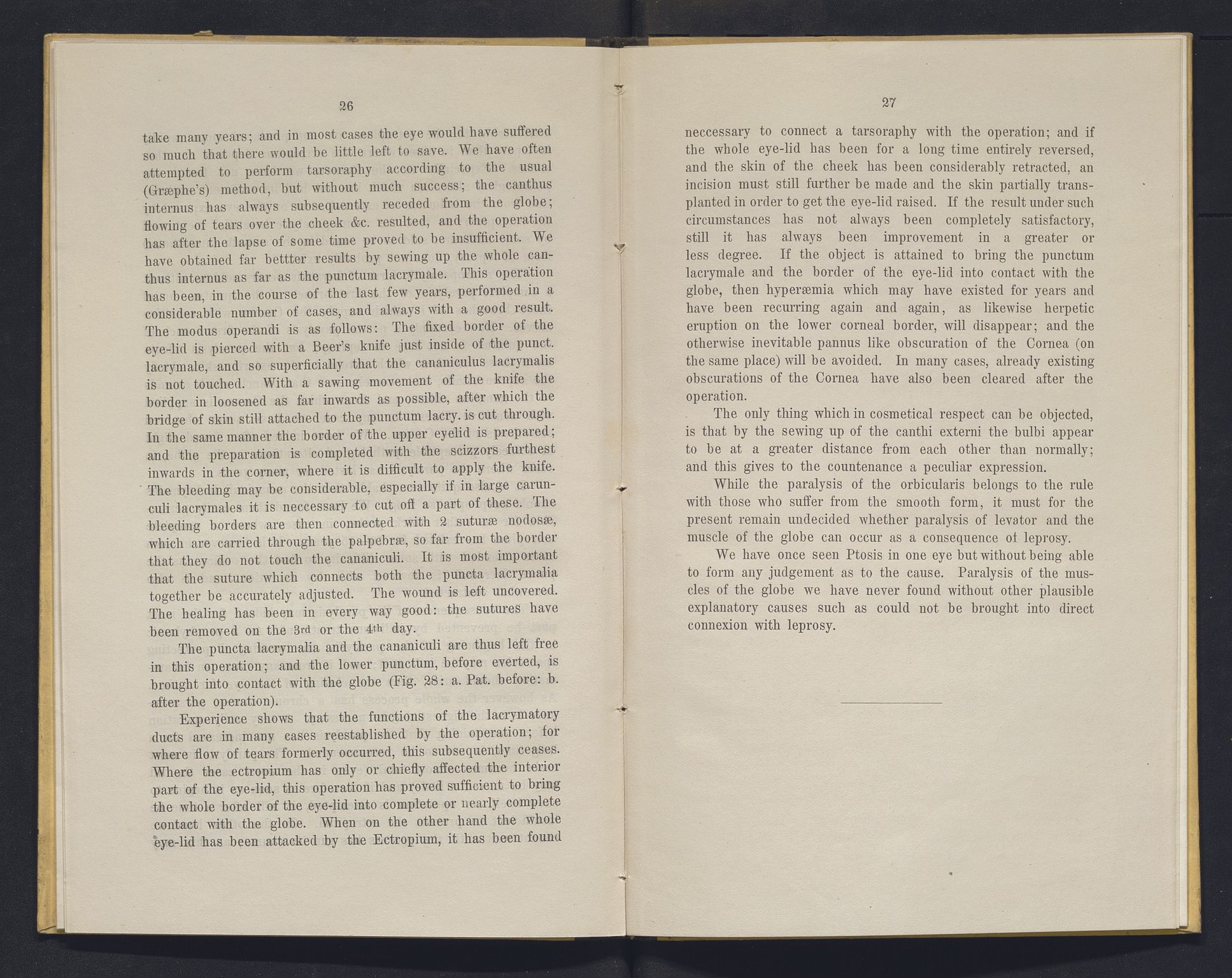 Lepraarkiver - Overlegen for den spedalske sykdom, AV/SAB-A-61001/E/L0001: The Leprous Diseases of the Eye with 6 colored plates by Dr. O.B. Bull and Dr. G.A. Hansen, 1873, p. 26-27