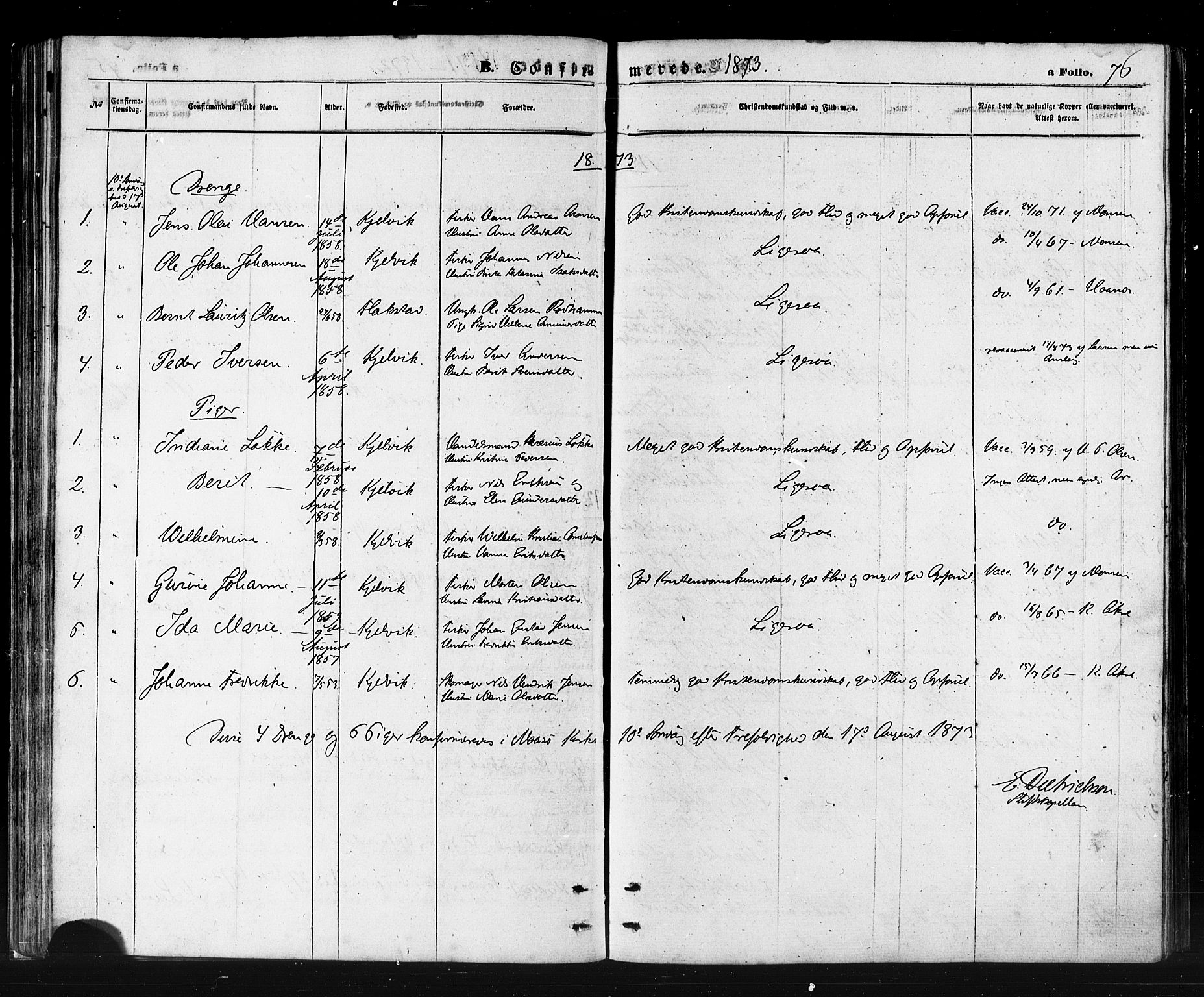 Måsøy sokneprestkontor, SATØ/S-1348/H/Ha/L0006kirke: Parish register (official) no. 6, 1861-1886, p. 76