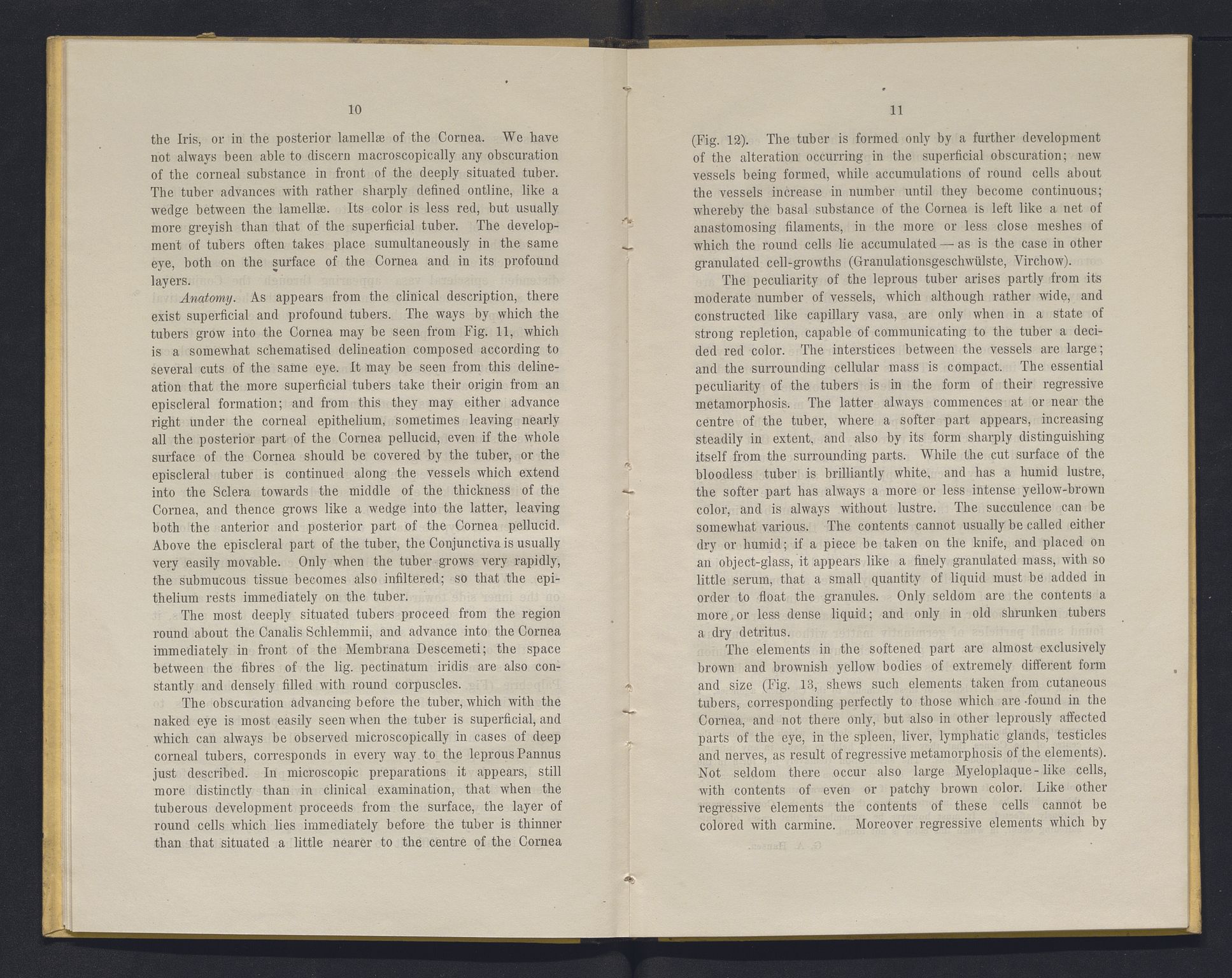 Lepraarkiver - Overlegen for den spedalske sykdom, AV/SAB-A-61001/E/L0001: The Leprous Diseases of the Eye with 6 colored plates by Dr. O.B. Bull and Dr. G.A. Hansen, 1873, p. 10-11