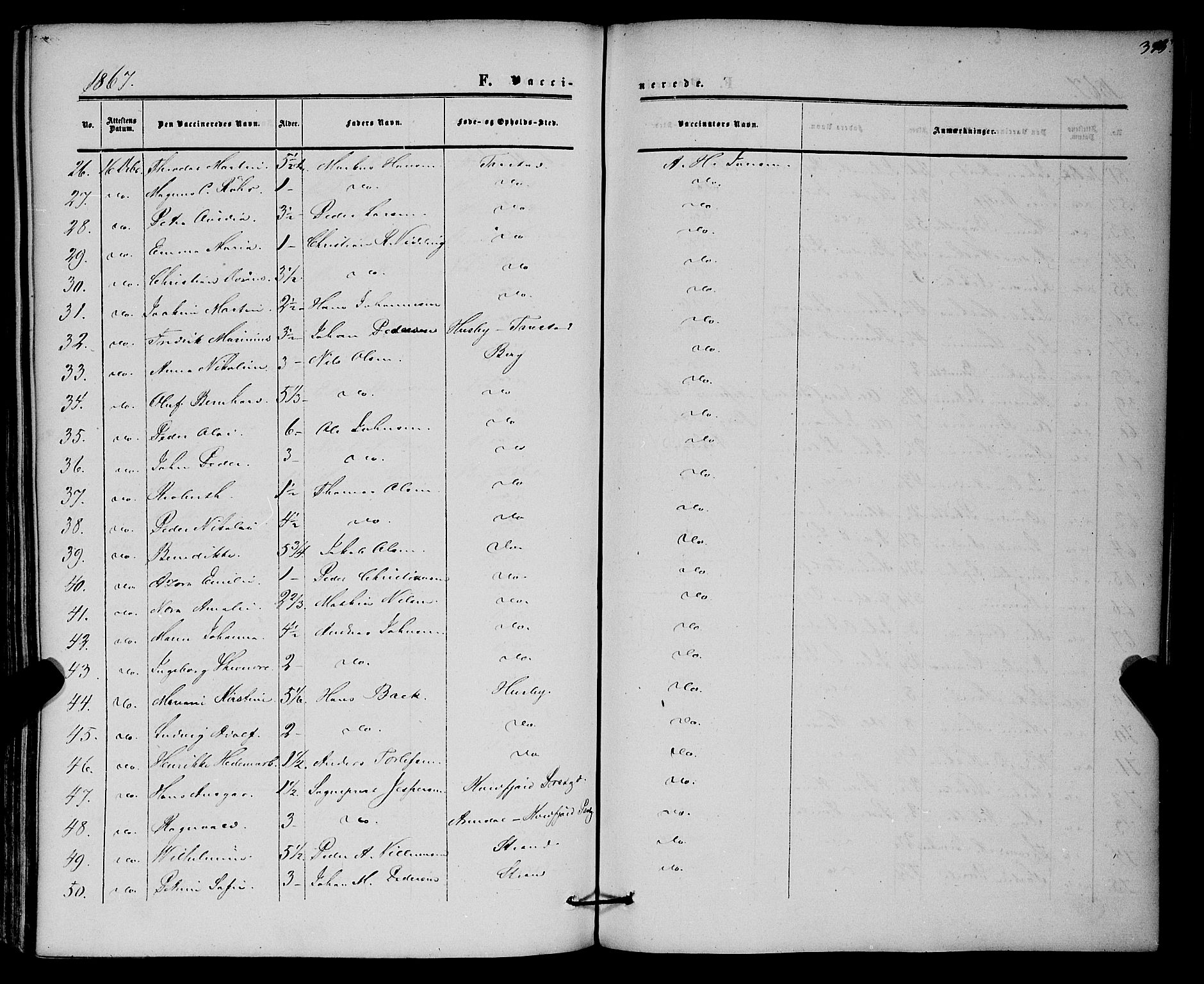 Kvæfjord sokneprestkontor, AV/SATØ-S-1323/G/Ga/Gaa/L0004kirke: Parish register (official) no. 4, 1857-1877, p. 315