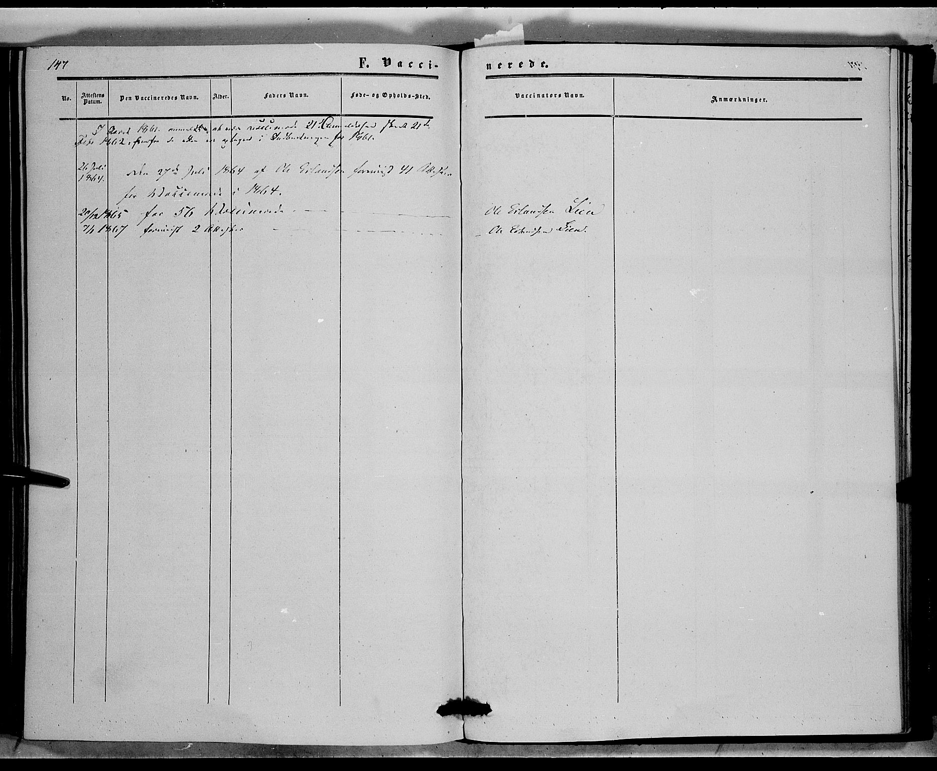 Sør-Aurdal prestekontor, SAH/PREST-128/H/Ha/Haa/L0006: Parish register (official) no. 6, 1849-1876, p. 147