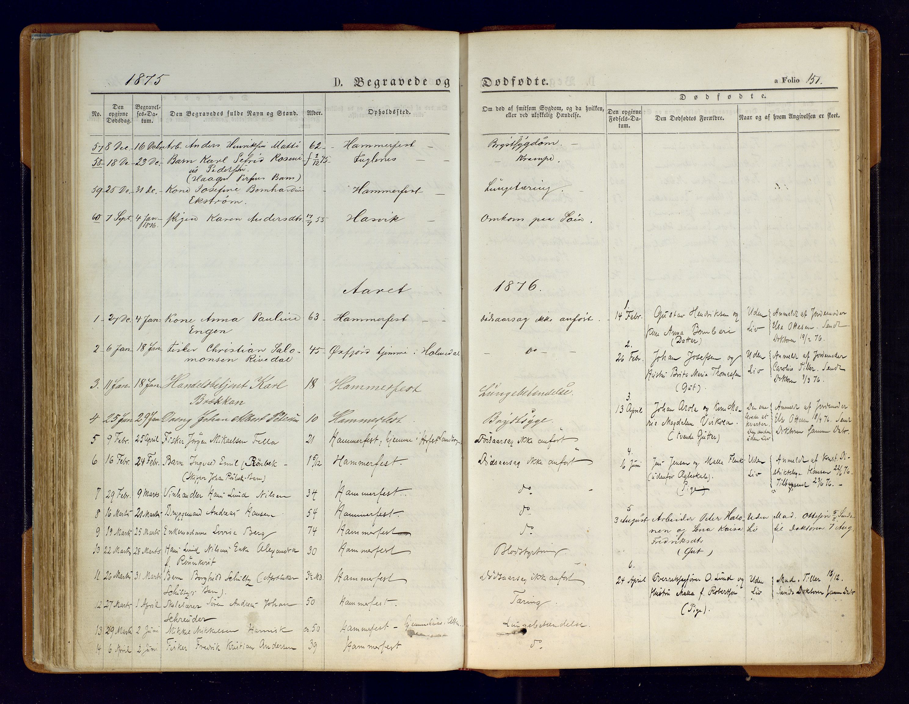 Hammerfest sokneprestkontor, SATØ/S-1347/H/Ha/L0006.kirke: Parish register (official) no. 6, 1869-1877, p. 151