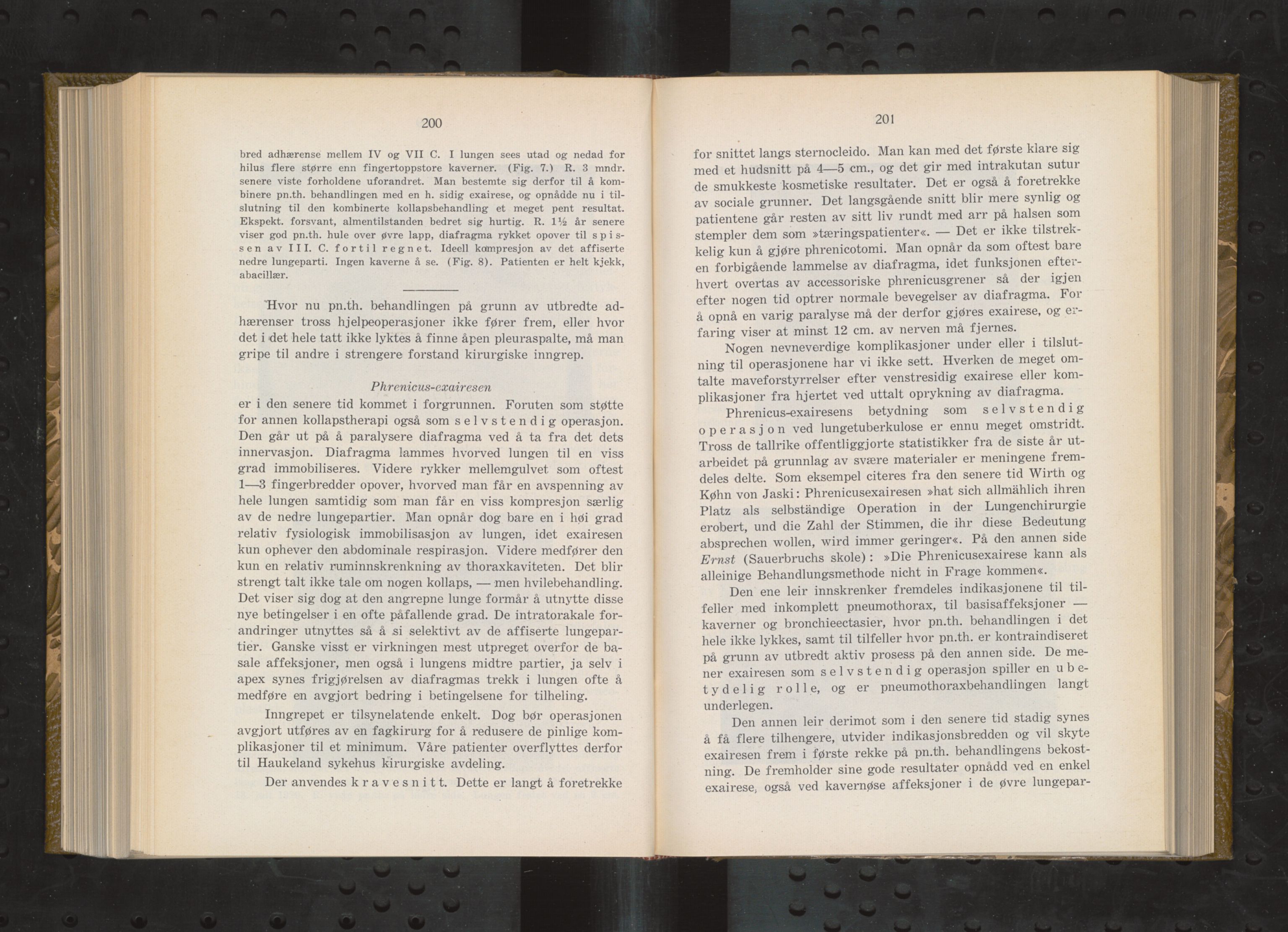 Haukeland Sykehus, Direktøren, BBA/A-2050.04/Æa/L0004: Årsberetninger 1929-1933, 1929-1933, p. 339