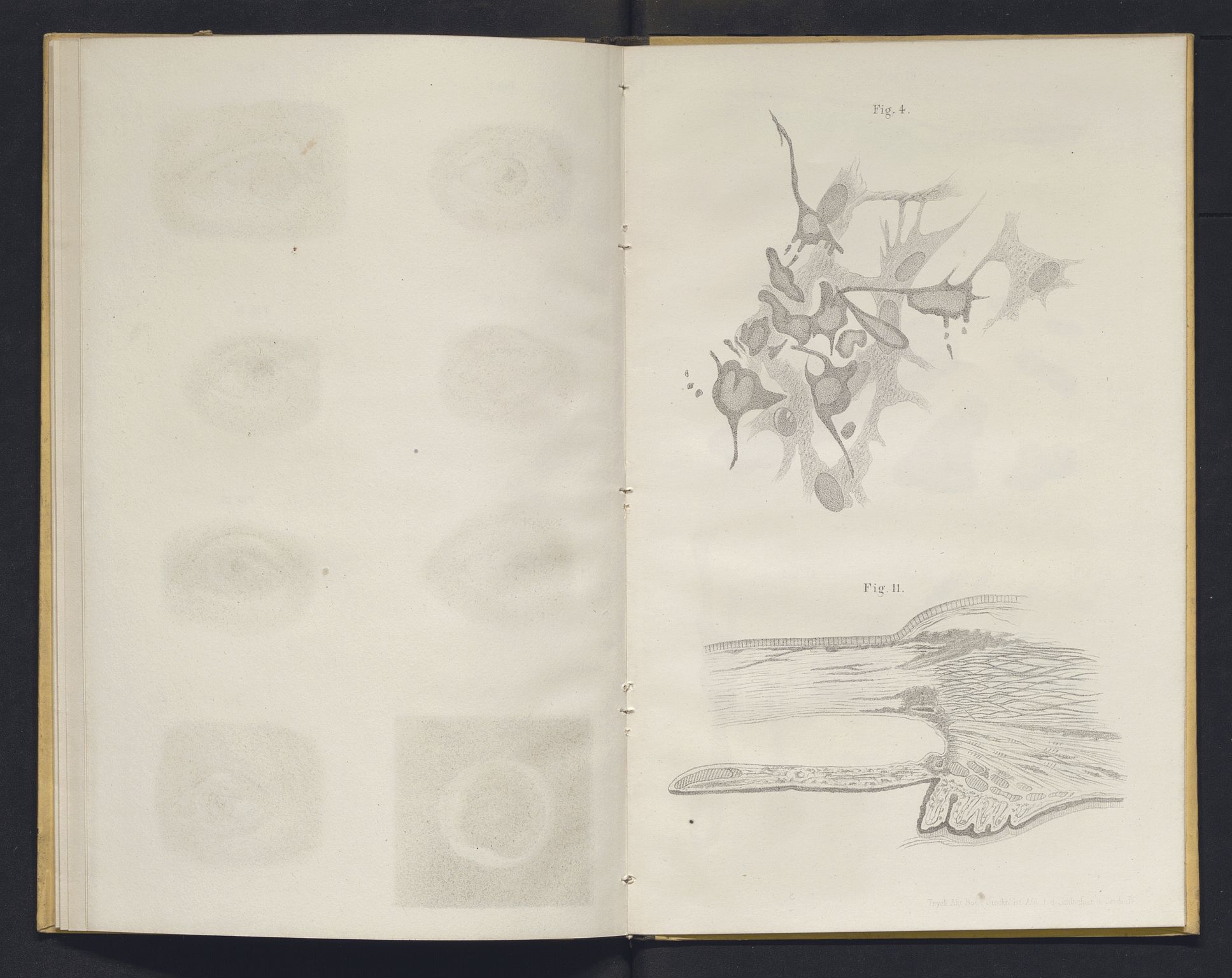 Lepraarkiver - Overlegen for den spedalske sykdom, AV/SAB-A-61001/E/L0001: The Leprous Diseases of the Eye with 6 colored plates by Dr. O.B. Bull and Dr. G.A. Hansen, 1873