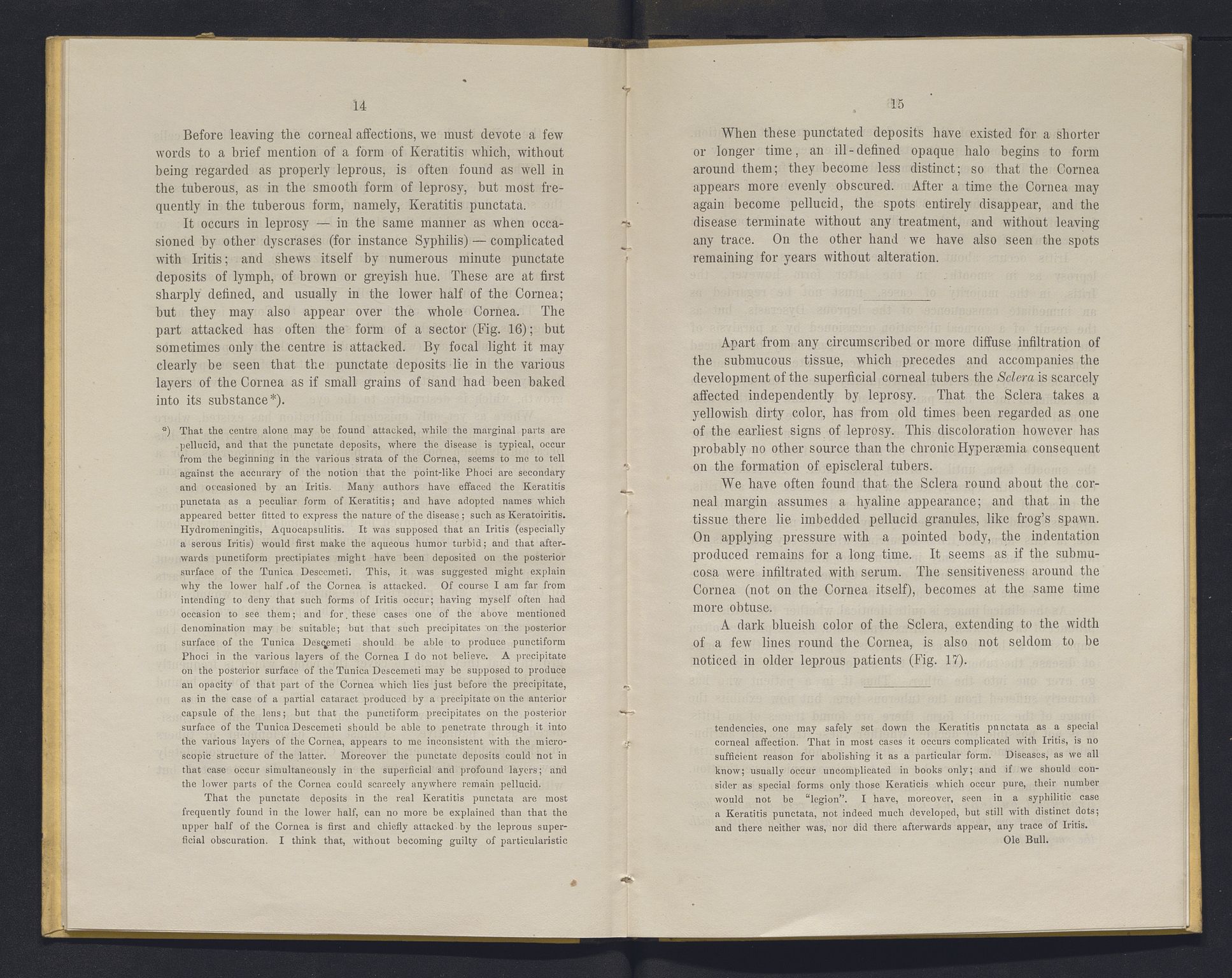 Lepraarkiver - Overlegen for den spedalske sykdom, AV/SAB-A-61001/E/L0001: The Leprous Diseases of the Eye with 6 colored plates by Dr. O.B. Bull and Dr. G.A. Hansen, 1873, s. 14-15