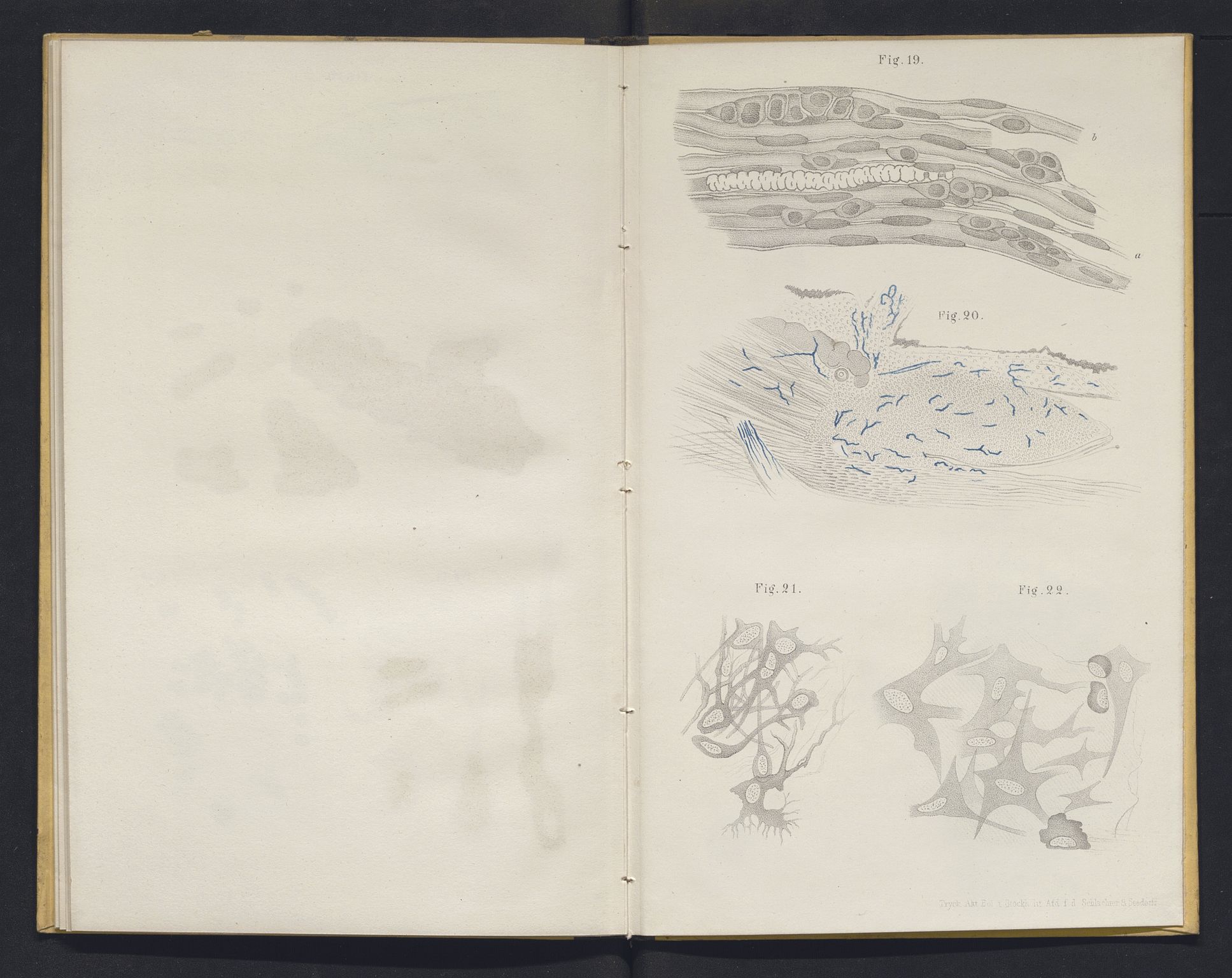 Lepraarkiver - Overlegen for den spedalske sykdom, AV/SAB-A-61001/E/L0001: The Leprous Diseases of the Eye with 6 colored plates by Dr. O.B. Bull and Dr. G.A. Hansen, 1873