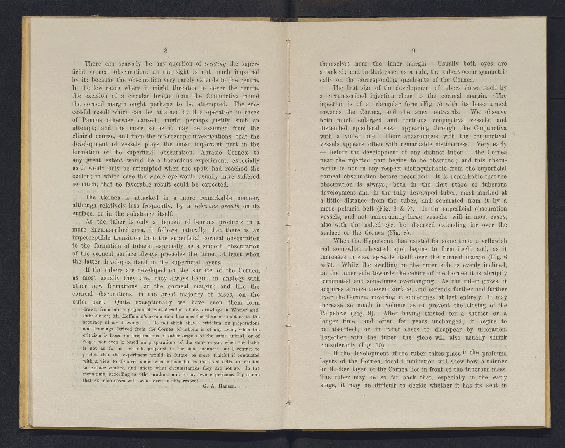 Lepraarkiver - Overlegen for den spedalske sykdom, AV/SAB-A-61001/E/L0001: The Leprous Diseases of the Eye with 6 colored plates by Dr. O.B. Bull and Dr. G.A. Hansen, 1873, s. 8-9